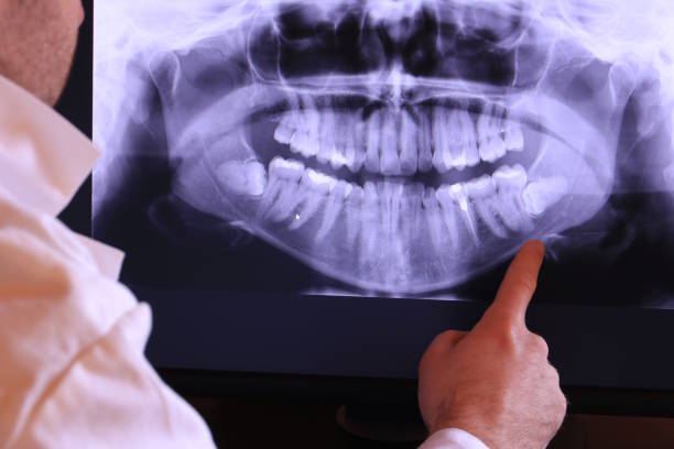 Best After-Hours Emergency Dentist in Thoreau, NM